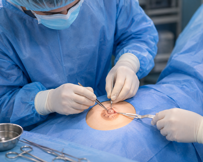 Surgeon consulting a patient about Inverted Nipple Correction